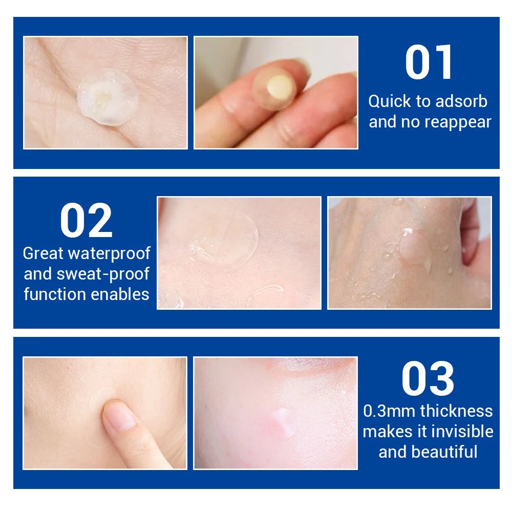 Acne Pimple Patches