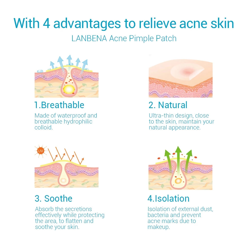 Acne Pimple Patches