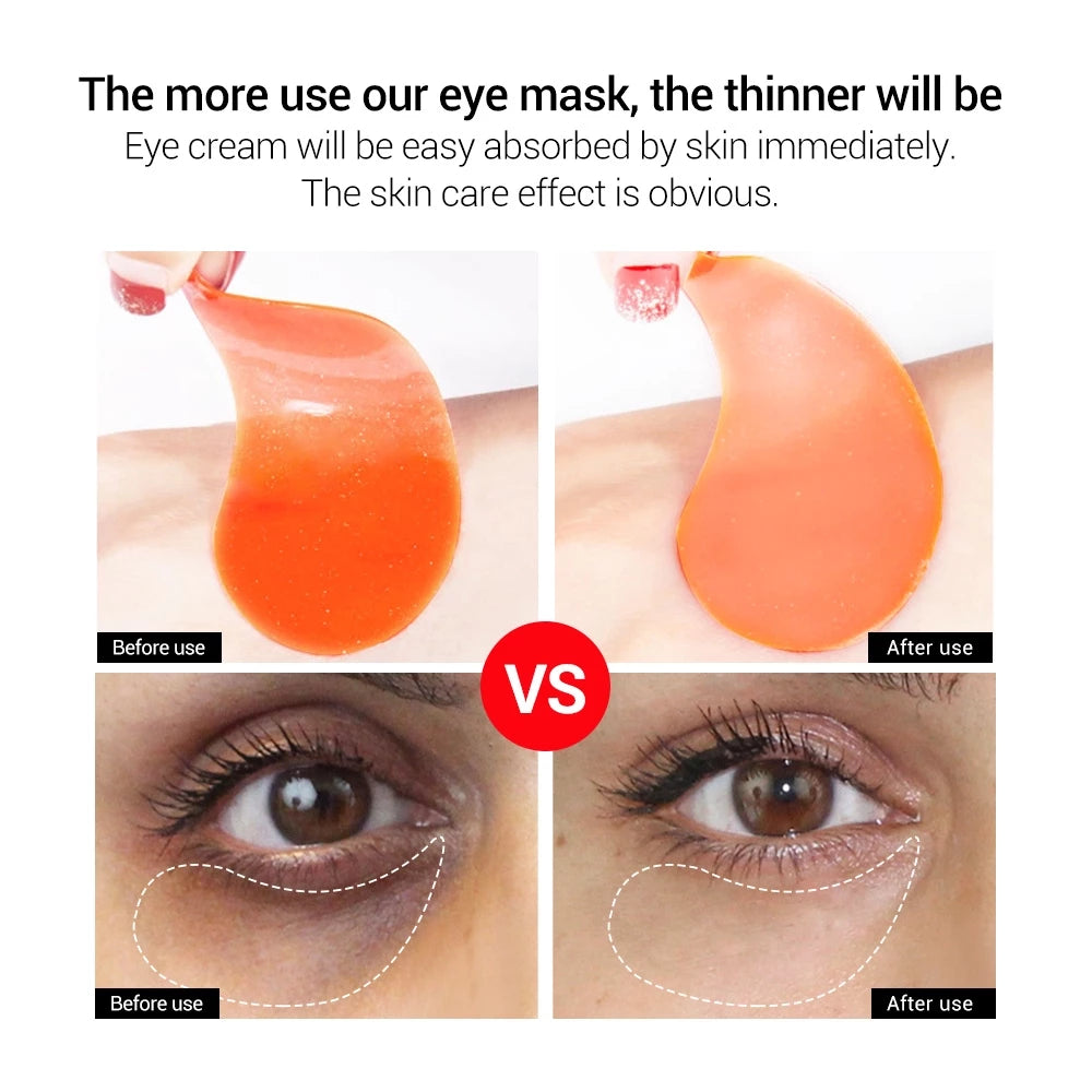 Vitamin C Hydra-gel Eye Patches