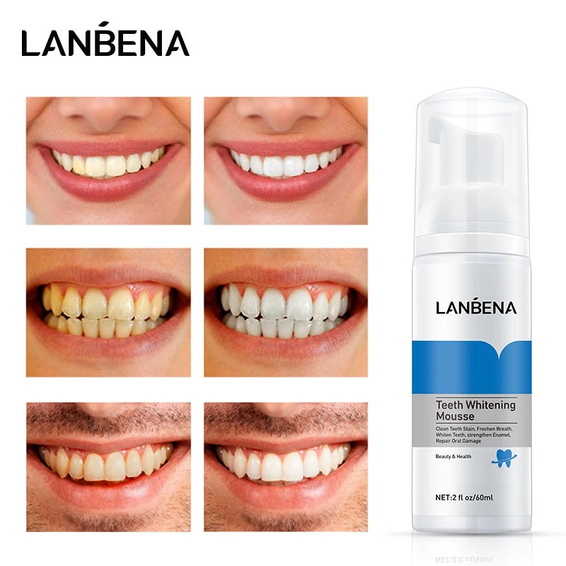 Teeth Whitening Mousse