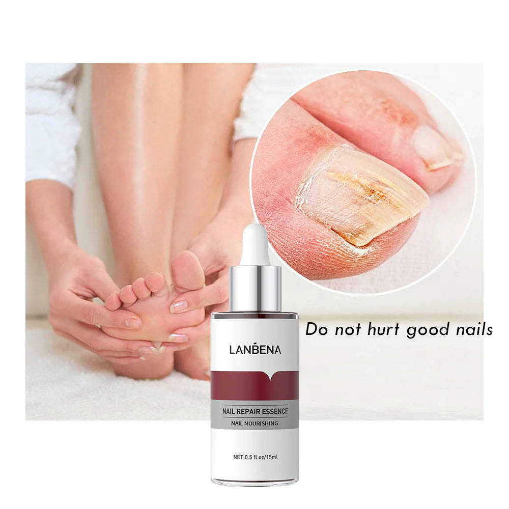 Nail Repair Serum For Fungus