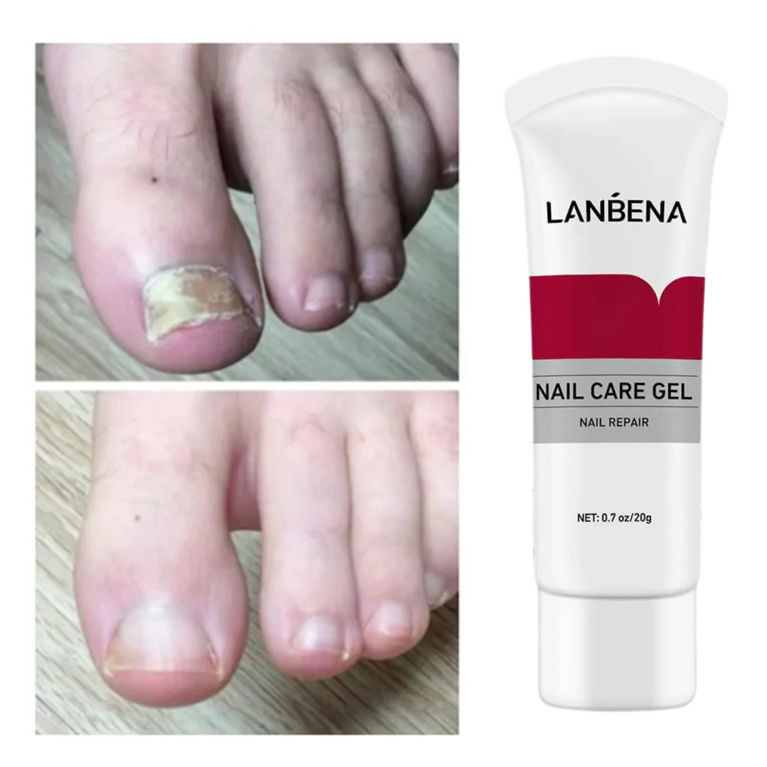Nail Repair Essence Gel