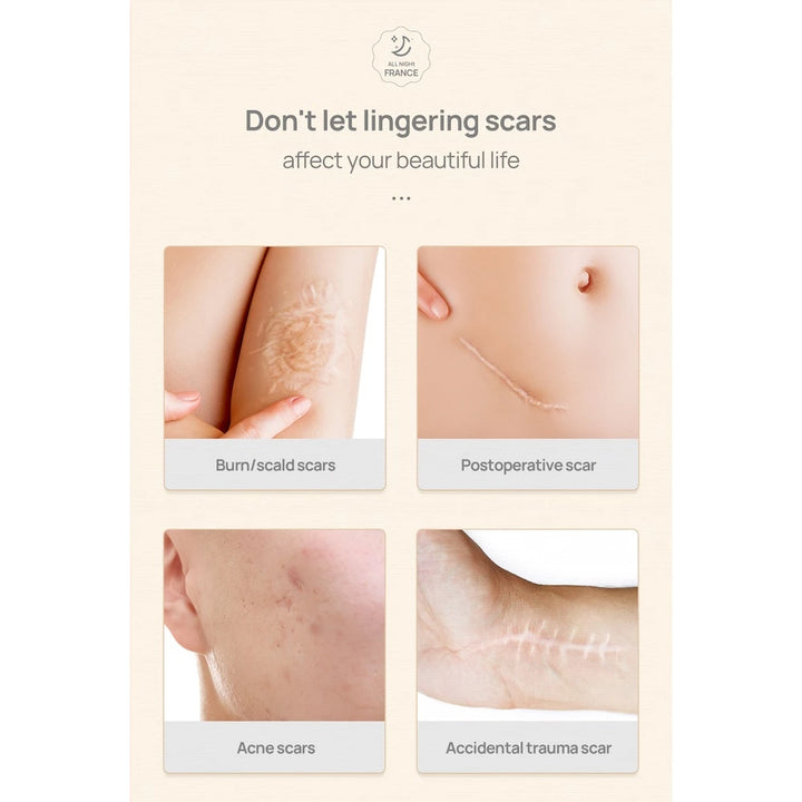 Stretch Marks Cream