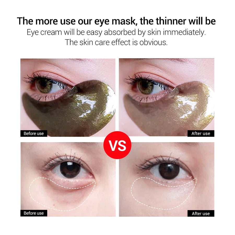Gold Black Pearl Hydra-gel Eye Patches