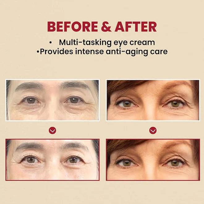 SEOUL 1988 Retinal Eye Cream