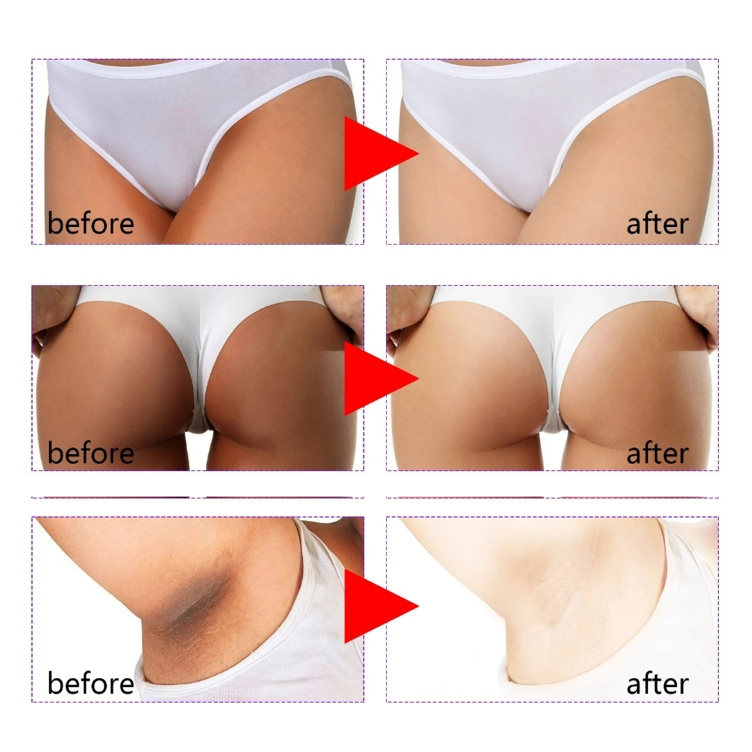Bikini Butter For Intimate Areas