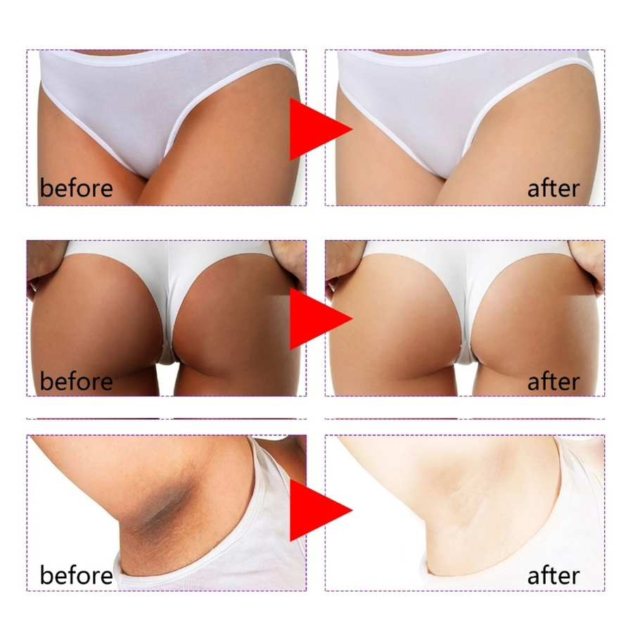 Bikini Butter For Intimate Areas