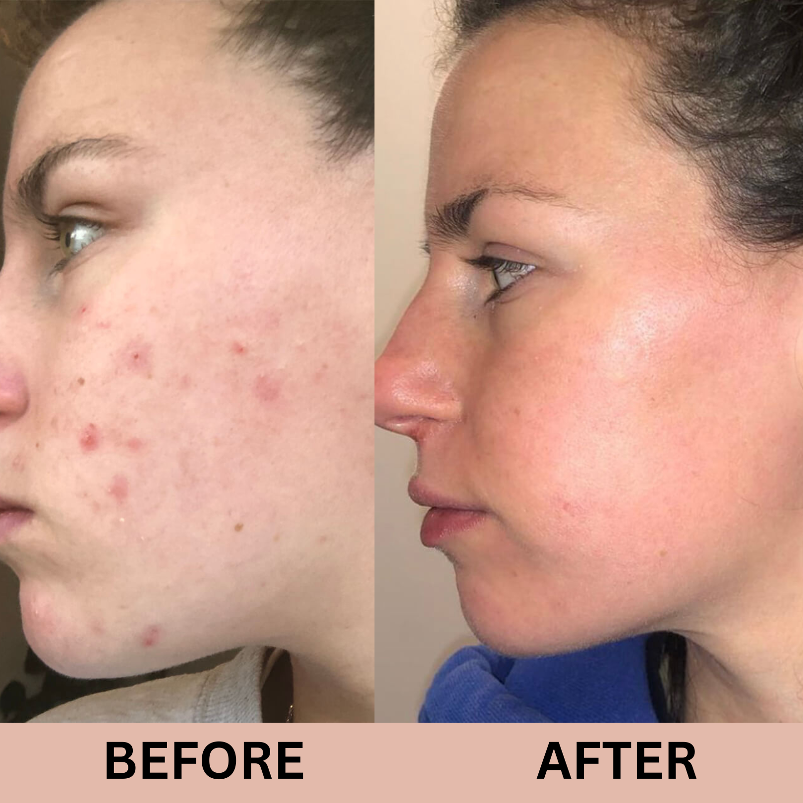 Dr Althea 345 Relief Cream