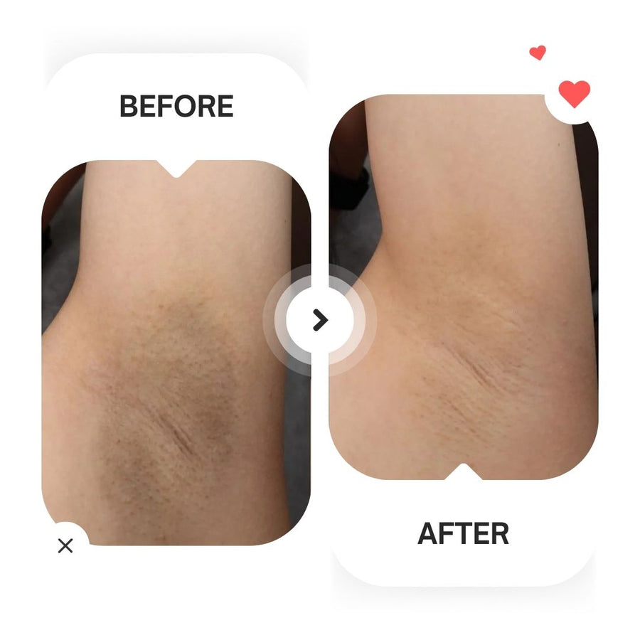 Arencia - Vitamin C Booster Shot