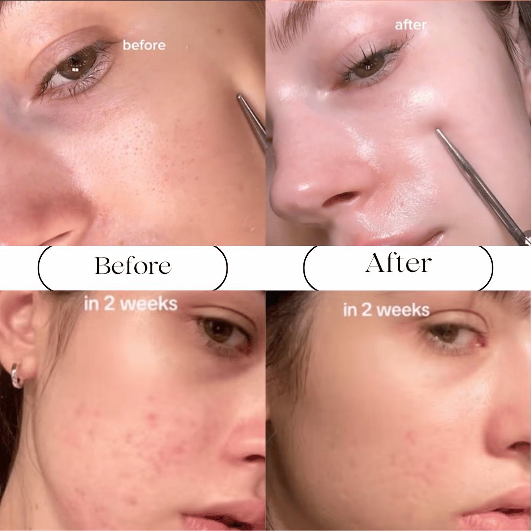 Viral Retinal Shot by Celimax