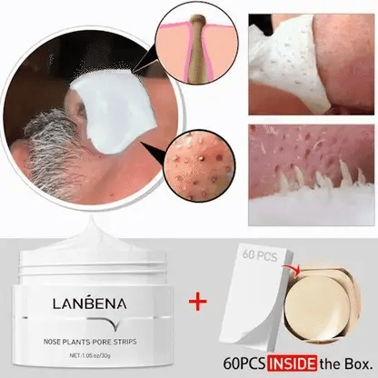 Blackhead Remover Mask 2.0