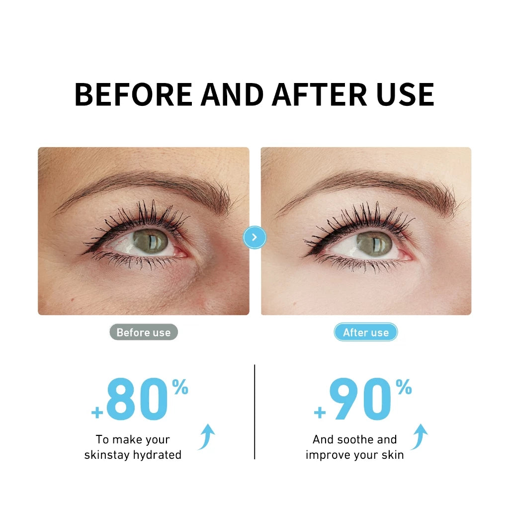 Hyaluronic Hydra-Gel Eye Patches