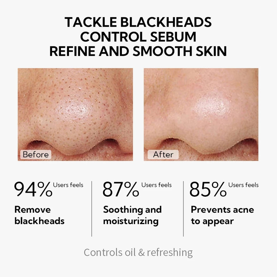Pore Treatment Serum