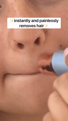 Facial Hair Removal
