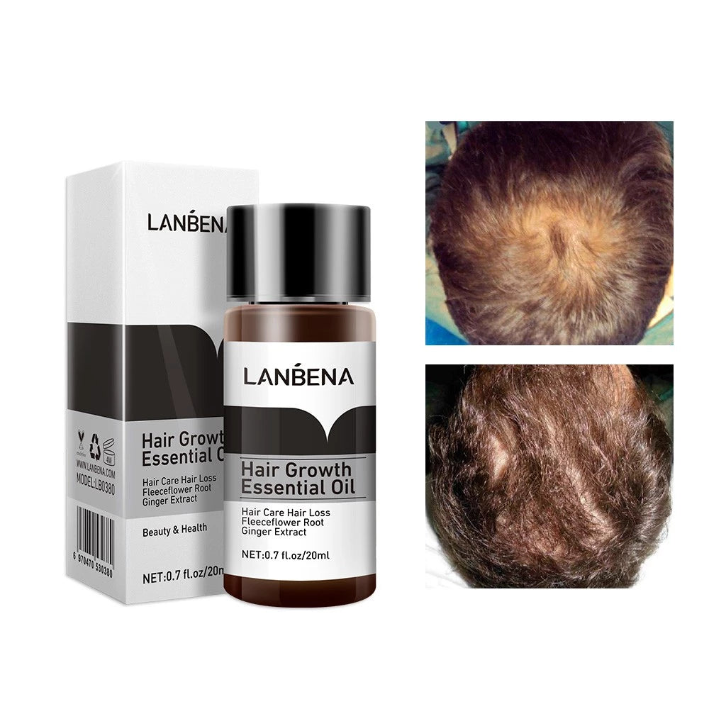 Hair Growth Serum