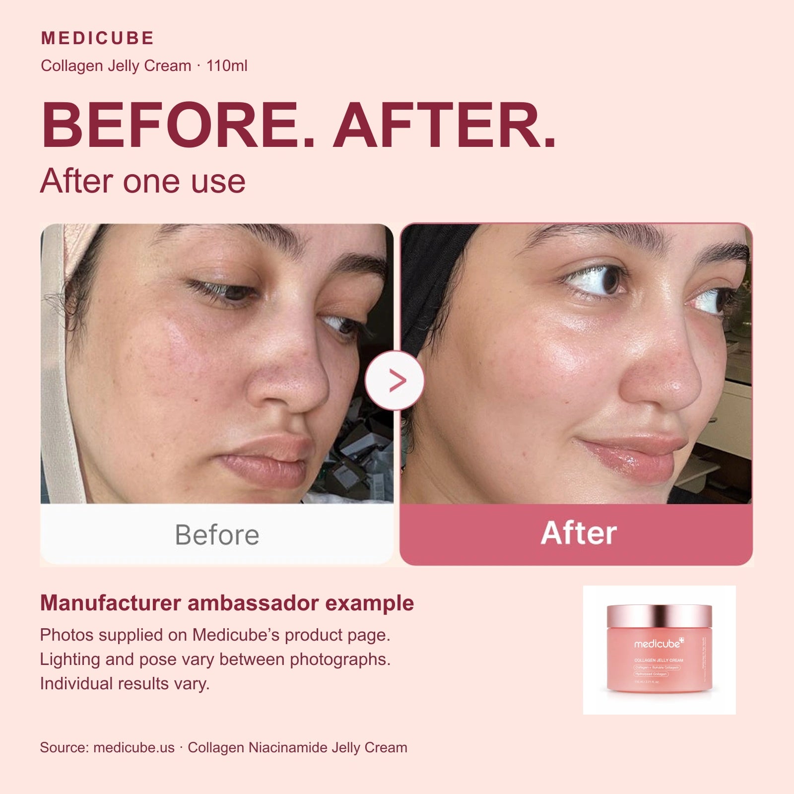 Medicube Collagen Jelly Cream 110ml: manufacturer ambassador before and after one use. Lighting and pose differ; individual results vary.