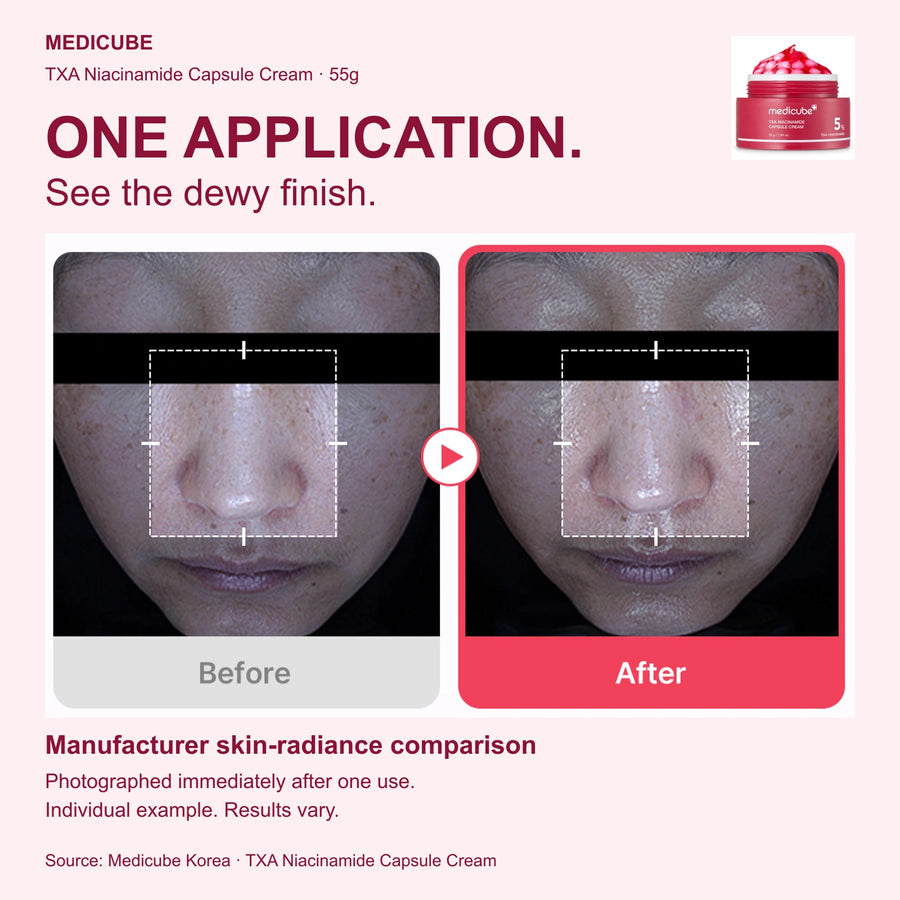 Medicube TXA Niacinamide Capsule Cream 55g: manufacturer photographs before and immediately after one use, showing the dewy finish. Individual results vary.