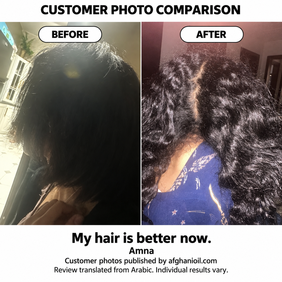 Before and after customer photo comparison shared by Amna on afghanioil.com. Customer-reported experience; individual results vary.