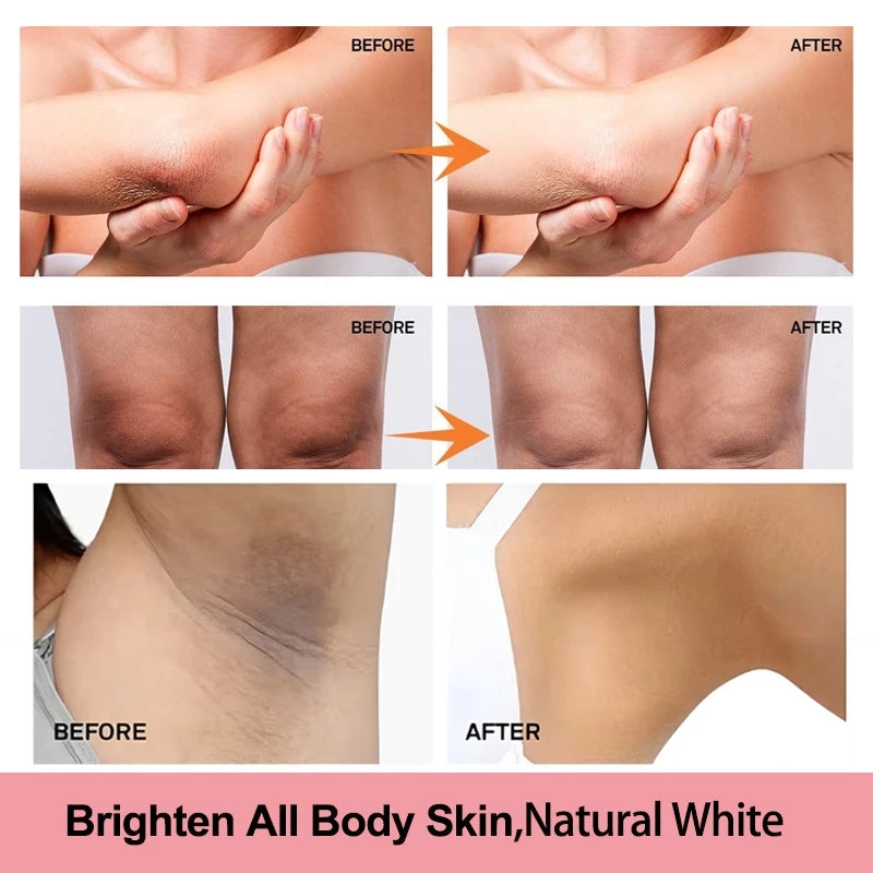 Kojic® Whitening Cream