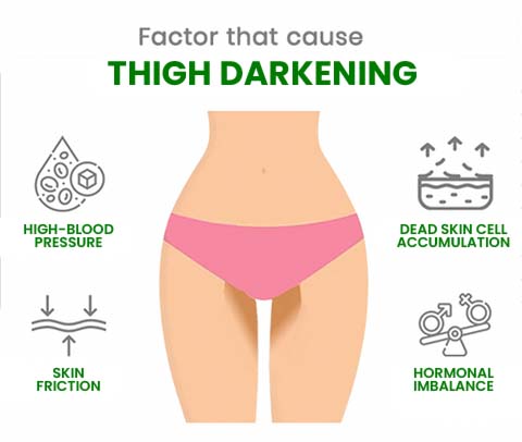 Kojic® Whitening Cream