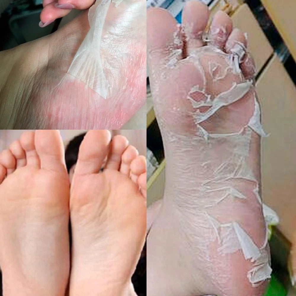Exfoliating Foot Peel Mask
